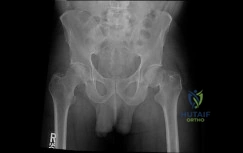 Orthopedic Surgery Board Review MCQs: AAOS Master Bank Part 87