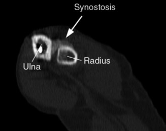 Illustration 103 for Right Shoulder Pain? Avoid This Common X-ray Mistake.