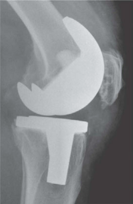 Illustration of oralexamination question infected - Dr. Mohammed Hutaif