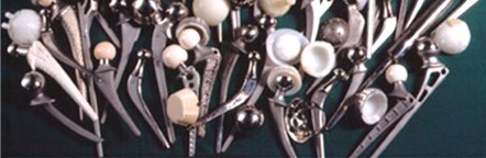 Illustration 2 for Maximizing Durability: Tribology and Bearing for Hip Implants