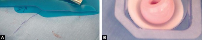 Illustration 29 for Posterolateral Surgical Approaches: Achieve Optimal Hip Replacement