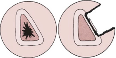 Illustration 19 for Decoding Von Willebrand Factor: Fundamental Basic Science Principles