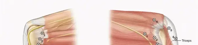 صورة توضيحية لـ منظار الكوع والرسغ: دليل شامل للمرضى نحو الشفاء مع الأستاذ الدكتور محمد هطيف