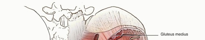 Total Hip Arthroplasty: Journey to Preventing Complications