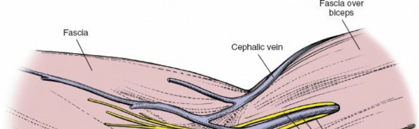 Illustration of elbow applied surgical - Dr. Mohammed Hutaif