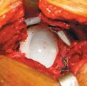 Clinical Image