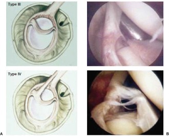 Illustration 23 for Acad Orthop Surg Challenge: Diagnose Shoulder Pain Case 1