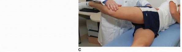 Illustration 4 for Periacetabular Osteotomy: Realigning your hip via the superior pubic ramus