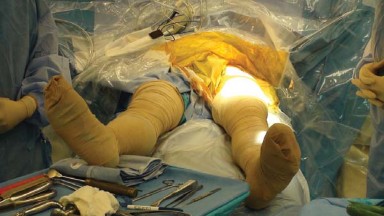 Illustration of anterior approach for total - Dr. Mohammed Hutaif