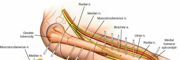 Mastering Safe External Fixation of the Humerus: Techniques & Placement