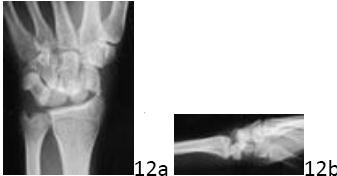 Orthopedic O Upper Extremity Review | Dr Hutaif General -...
