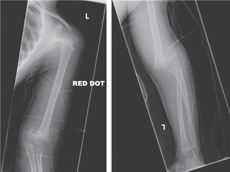 Illustration 23 for Master Hands and Paediatric Orthopaedics: Diagnose & Treat