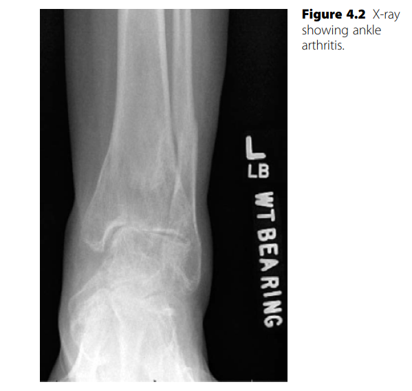 Ankle Structured Oral: Expert Answers for Arthritis Cases