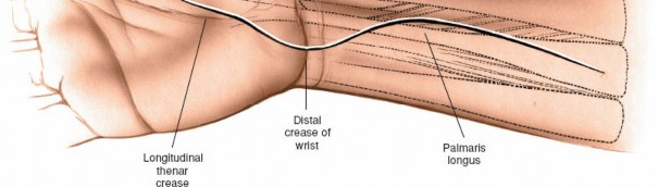 Illustration 77 for Essential Surgical Approaches: Uncover Every Aspect of the Wrist