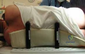 Biomechanical Forces in Cam Impingement
