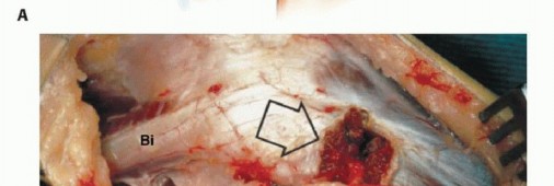 تشريح الشظية البعيدة ومفصل الكاحل