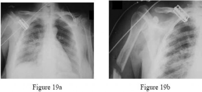 Orthopedic Surgery Mock Exam - Set EA6994