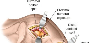 Illustration 114 for Essential Guide: Mastering Every Approach to the Shoulder