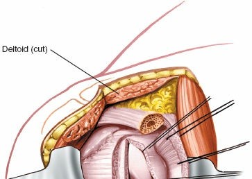 Illustration 37 for Essential Guide: Mastering Every Approach to the Shoulder