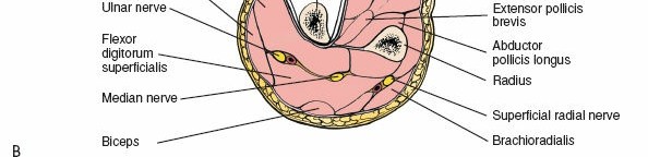 Illustration 52 for Mastering Approaches to the Upper Third of the Radius