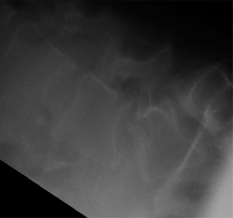 Illustration 17 for Master Orthopedic Spine Cases: Sharpen Your Diagnostic Skills