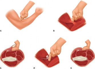 Illustration 130 for Acad Orthop Surg Challenge: Diagnose Shoulder Pain Case 1
