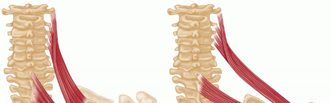 Illustration 15 for End CN XI Palsy Pain: The Eden-Lange Procedure Solution