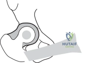 Illustration of nevin uicc nevin - Dr. Mohammed Hutaif