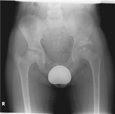 Illustration 24 for Master Hands and Paediatric Orthopaedics: Diagnose & Treat