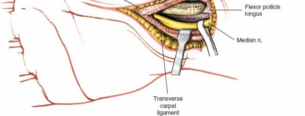 Illustration 243 for Essential Surgical Approaches: Uncover Every Aspect of the Wrist