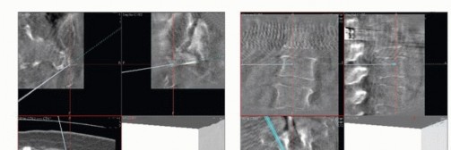 صورة طبية: جراحة أورام العجز: الحفاظ على وظائف الأمعاء والمثانة مع الأستاذ الدكتور محمد هطيف في صنعاء
