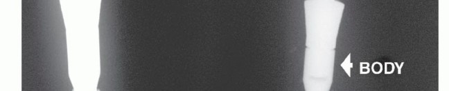 وصف طبي دقيق للمريض