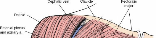 Illustration 56 for Essential Guide: Mastering Every Approach to the Shoulder