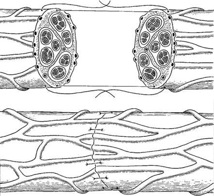 Illustration 4 for Decoding Von Willebrand Factor: Fundamental Basic Science Principles