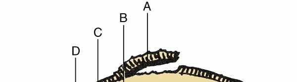 Articular Cartilage: Orthopedic Anatomy, Biomechanics & Clinical Pathology