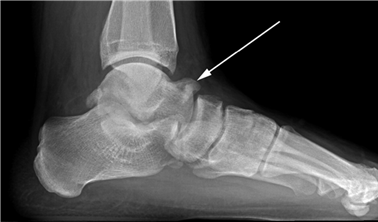 Illustration 49 for First Metatarsal Surgery: Expert Solutions for Foot & Ankle Pain