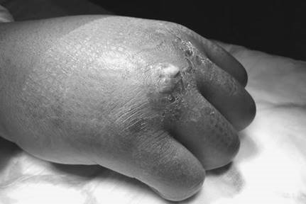 Illustration 6 for Master Hands and Paediatric Orthopaedics: Diagnose & Treat