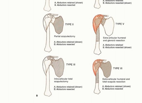 Surgical classification