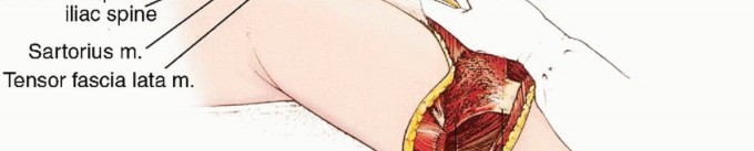 صورة توضيحية لـ استئصال نصف الحوض بالرفرفة الأمامية: حلول متقدمة لأورام الحوض الصعبة مع الأستاذ الدكتور محمد هطيف في صنعاء