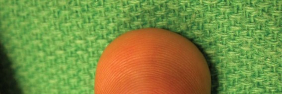 Illustration of base of the distal - Dr. Mohammed Hutaif