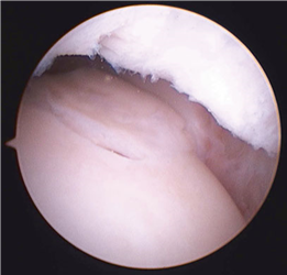 Illustration 5 for First Metatarsal Surgery: Expert Solutions for Foot & Ankle Pain