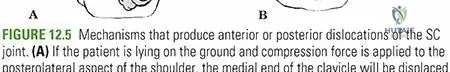 Sternoclavicular Joint Injury: A Comprehensive Academic Review of Epidemiology, Anatomy, and Biomechanics