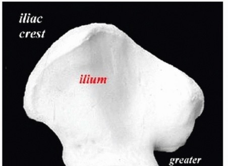 Fixing Posterior Pelvic Ring Instability: Sacrum & SI Joint ORIF