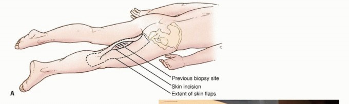 وصف طبي دقيق للمريض