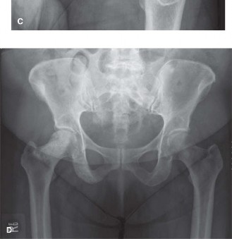 Illustration 4 for Mastering Oncology Cases: Multiple Myeloma & Bone Scan Nuances