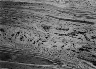 Illustration 52 for Master Diagnosis: Shoulder & Elbow Cases (Reproduced with Permission)