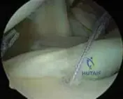 Illustration of test positive result - Dr. Mohammed Hutaif