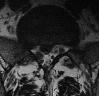 Illustration 8 for Master Orthopedic Spine Cases: Sharpen Your Diagnostic Skills