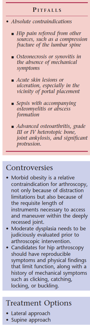 Illustration of hip arthroscopy hip arthroscopy - Dr. Mohammed Hutaif