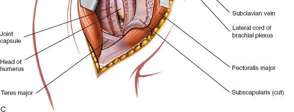 Illustration 48 for Essential Guide: Mastering Every Approach to the Shoulder
